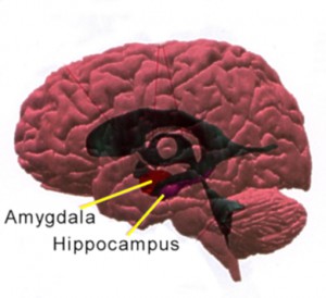 amygdala_hippocampus_lateral_large